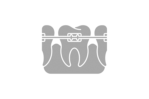 Pourquoi est-il recommandé de consulter l’orthodontiste avant l’âge de 6 ans ?